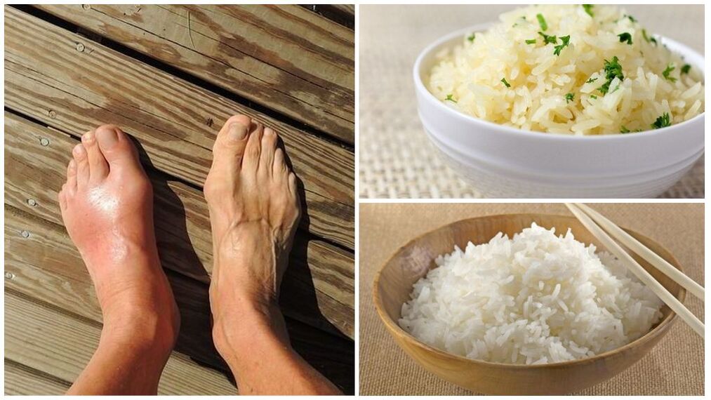 Se recomienda una dieta a base de arroz para quienes padecen gota. 